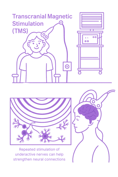 Personalised Treatment TMS Therapy