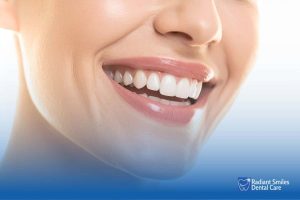 Teeth Cleaning General Dentistry